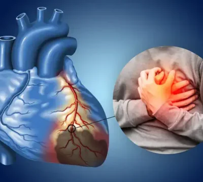 Understanding-Cardiac-Risk-Profiles